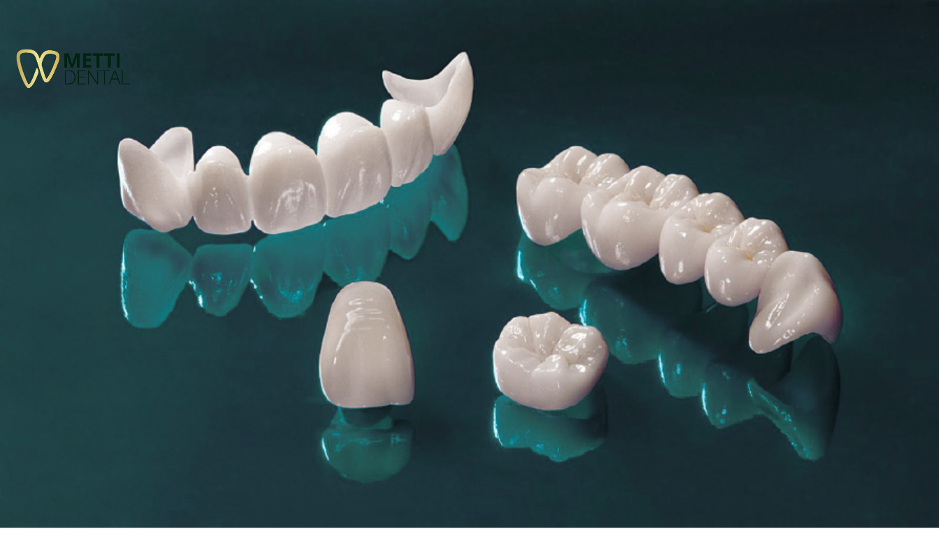 Răng sứ thẩm mỹ Zirconia nổi bật với độ bền cao và tính thẩm mỹ vượt trội