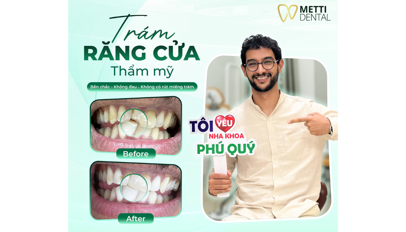 Nha khoa tổng quát tại Metti Dental cung cấp đa dạng dịch vụ chăm sóc và điều trị răng miệng toàn diện
