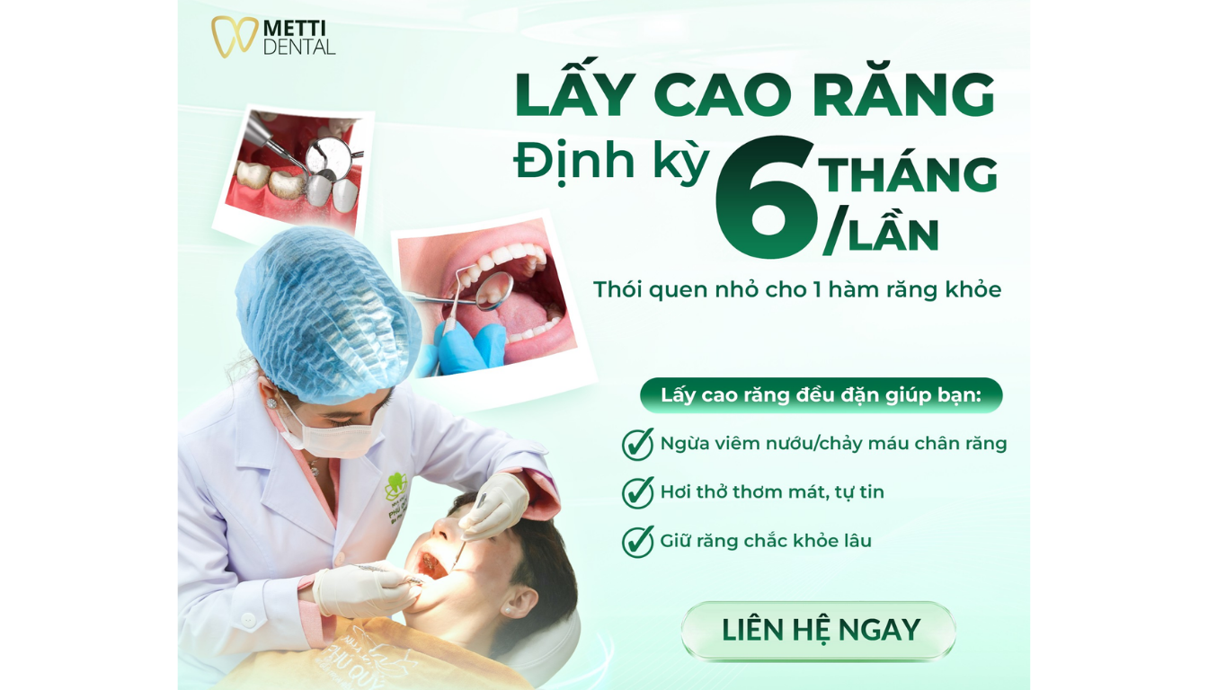 Nha khoa tổng quát giúp phát hiện sớm các tình trạng răng miệng cần thăm khám và điều trị kịp thời