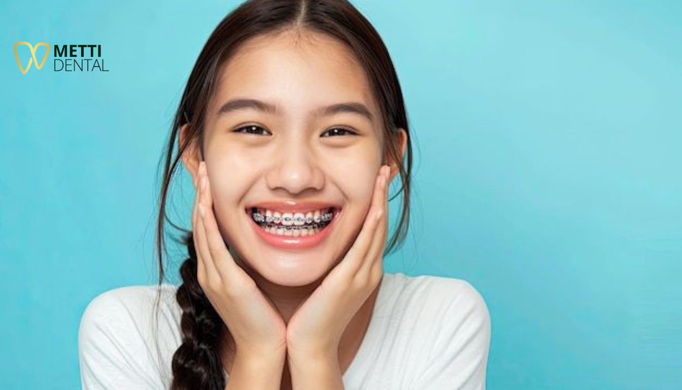 Niềng Răng Bao Nhiêu Tuổi Là Tốt Nhất