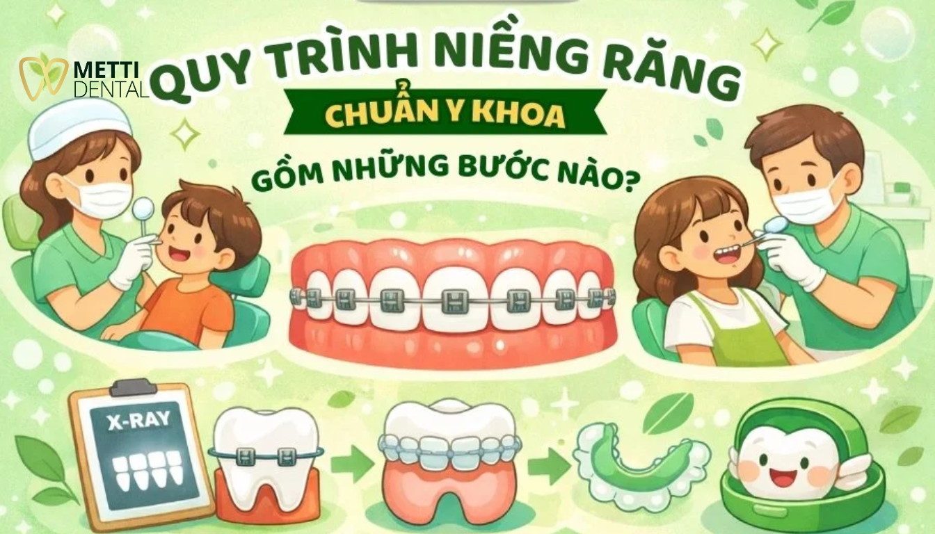 Quy Trình Niềng Răng Chuẩn Y Khoa